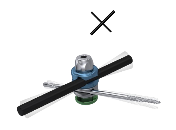 X-Frame External Fixation System
